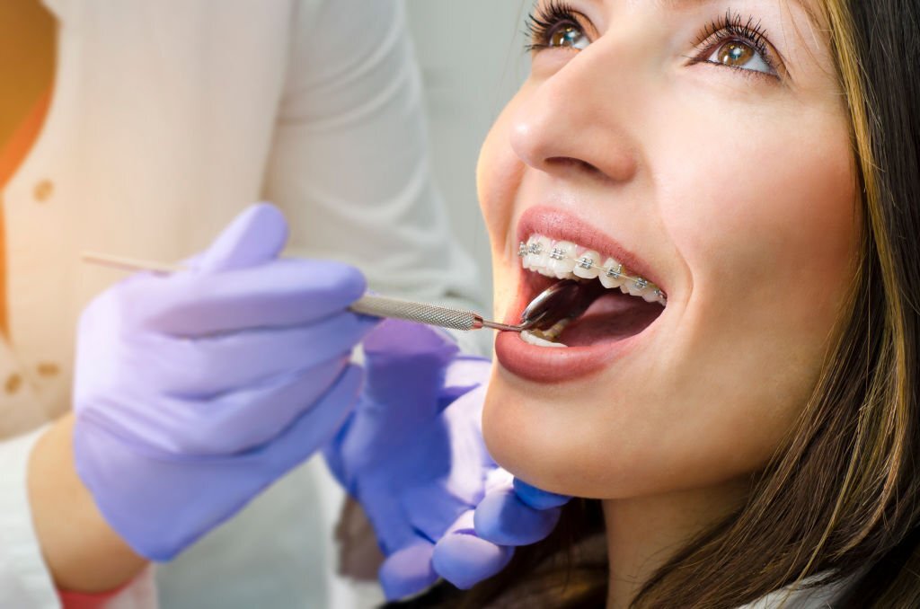 Different Types Of Orthodontic Treatments orthodontist in Garland tx