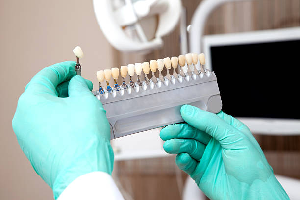Dental Bonding vs. Veneers: Choosing Your Smile Upgrade_FI