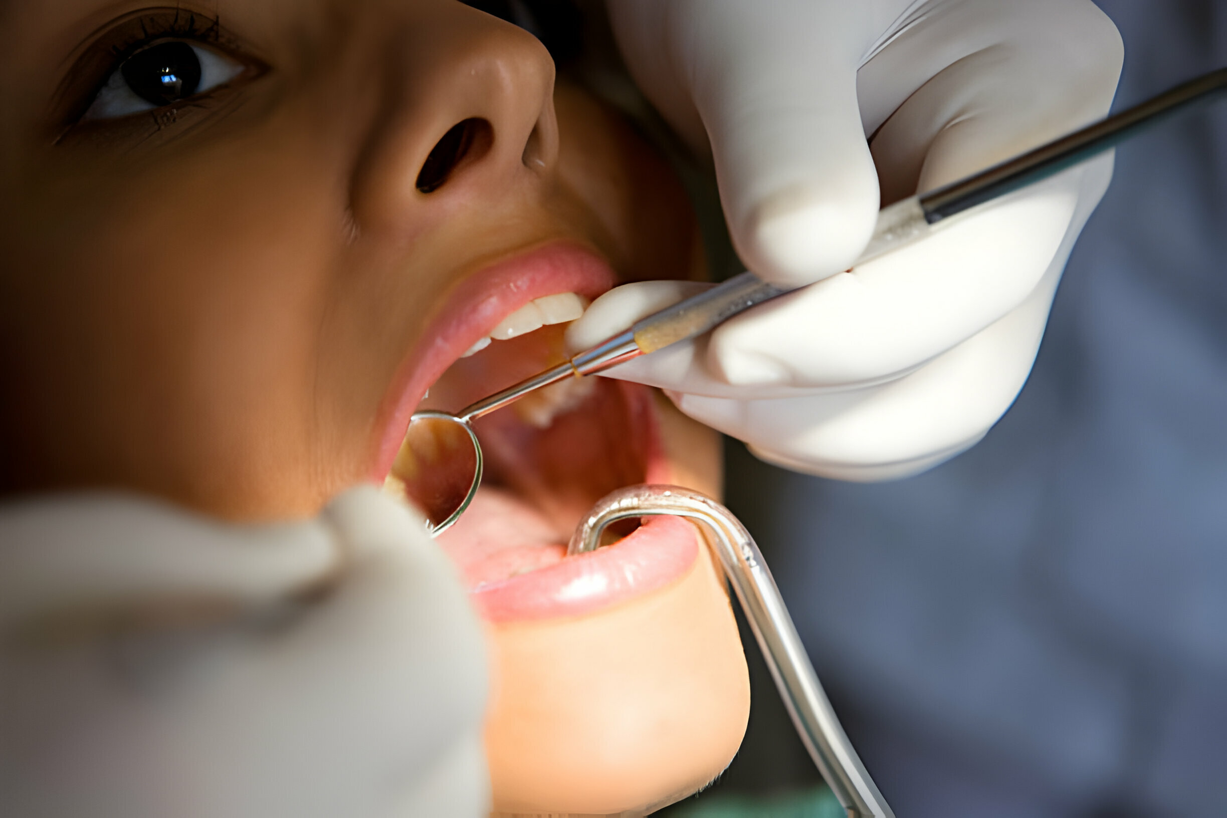 Understanding Root Canals: How They Work and Why They Save Teeth_2
