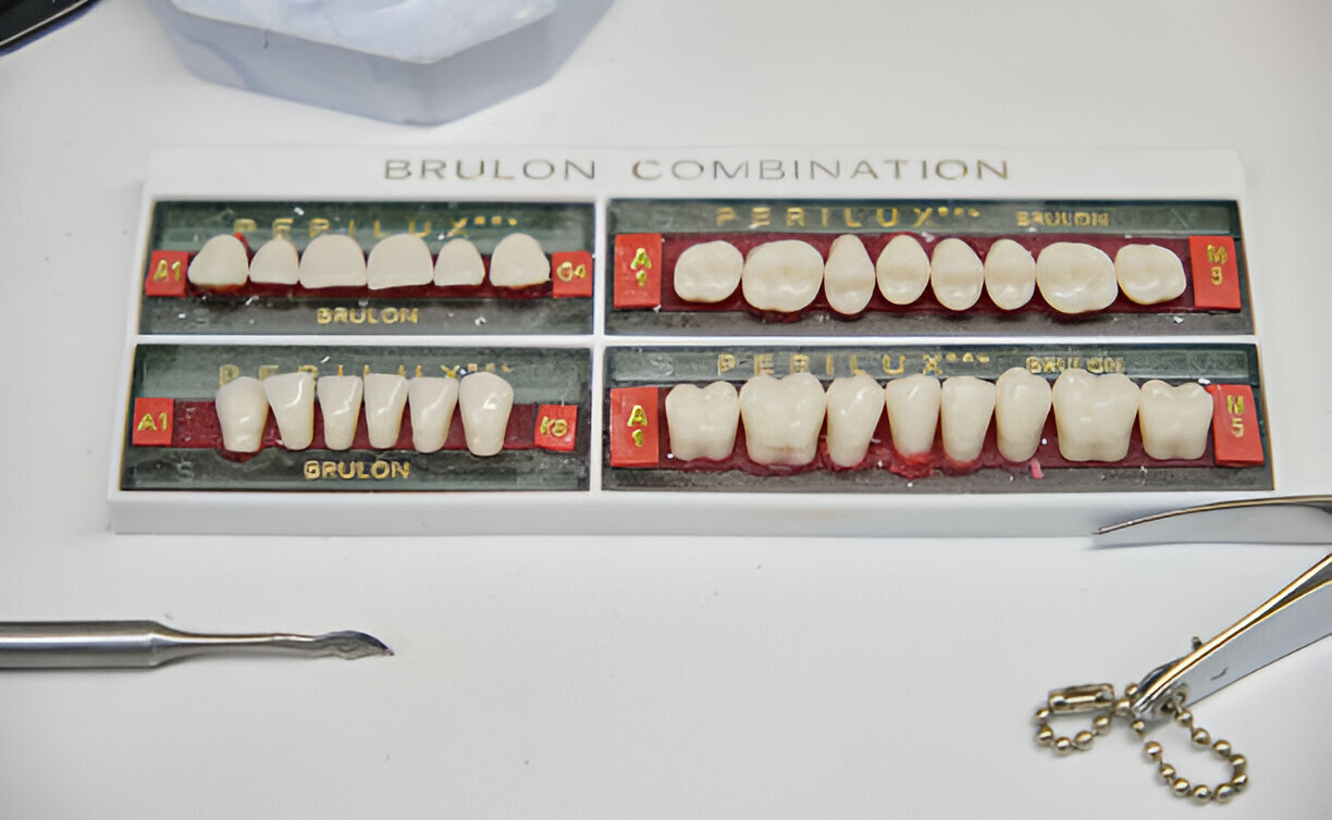Maintaining Your Porcelain Veneers: Tips for Longevity and Durability_FI