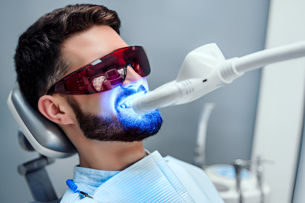 Teeth Whitening Options in Jacksonville, TX: What to Expect